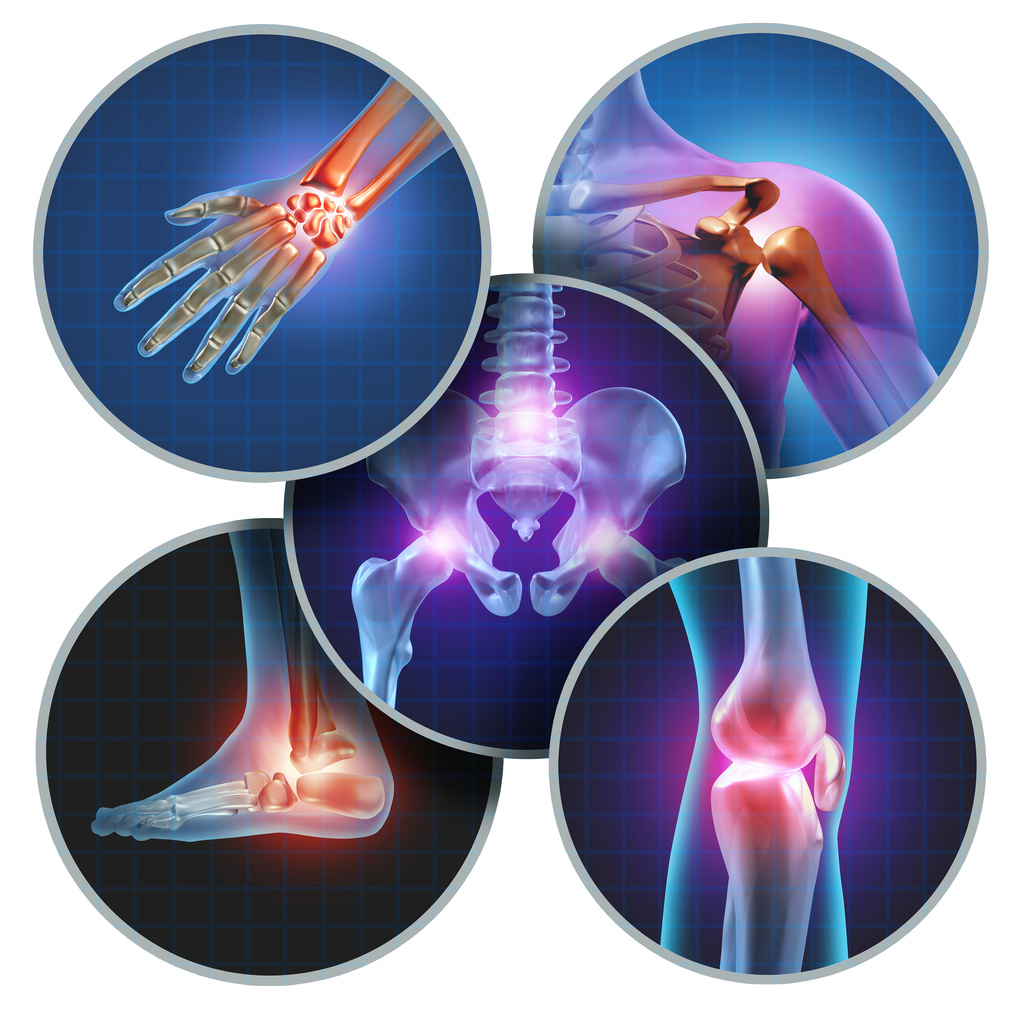 Human painful joints concept with the skeleton anatomy of the body with a group of sores with glowing joint pain and injury or arthritis illness symbol for health care and medical symptoms.
